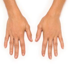 Hands - Before and After
